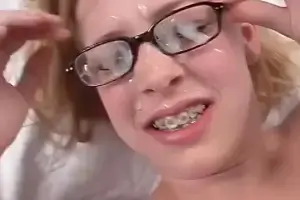 Teens with Braces and Glasses